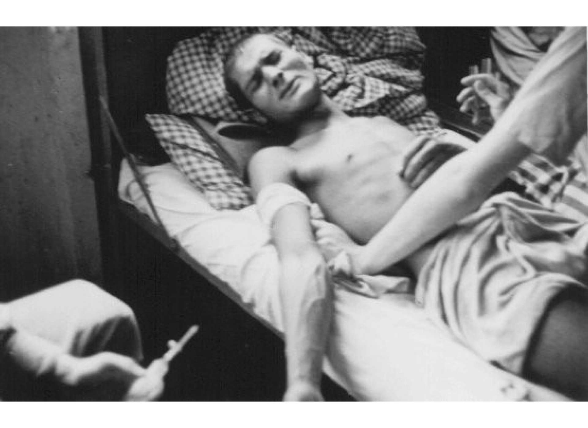 Romani victim of Nazi medical experiments to make seawater drinkable. Dachau, 1944. Credit: National Archives and Records Administration, College Park, Maryland. Courtesy of the United States Holocaust Memorial Museum.